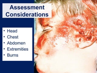 Assessment
Considerations
• Head
• Chest
• Abdomen
• Extremities
• Burns
 