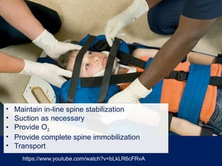 • Maintain in-line spine stabilization
• Suction as necessary
• Provide O2
• Provide complete spine immobilization
• Transport
https://www.youtube.com/watch?v=bLkLR6cFRvA
 