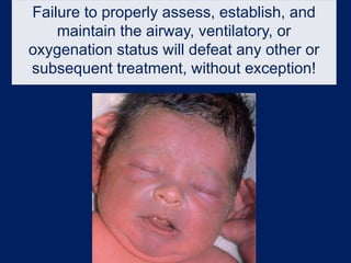 Failure to properly assess, establish, and
maintain the airway, ventilatory, or
oxygenation status will defeat any other or
subsequent treatment, without exception!
 