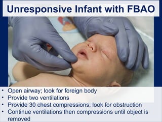 Unresponsive Infant with FBAO
• Open airway; look for foreign body
• Provide two ventilations
• Provide 30 chest compressions; look for obstruction
• Continue ventilations then compressions until object is
removed
 
