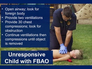 Unresponsive
Child with FBAO
• Open airway; look for
foreign body
• Provide two ventilations
• Provide 30 chest
compressions; look for
obstruction
• Continue ventilations then
compressions until object
is removed
 
