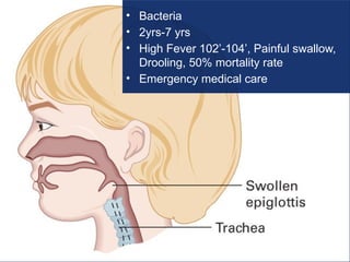 • Bacteria
• 2yrs-7 yrs
• High Fever 102’-104’, Painful swallow,
Drooling, 50% mortality rate
• Emergency medical care
 