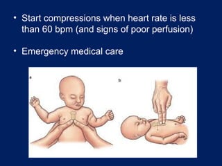 • Start compressions when heart rate is less
than 60 bpm (and signs of poor perfusion)
• Emergency medical care
 