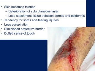 Chapter 39 Geriatrics power point for EMT | PPTX