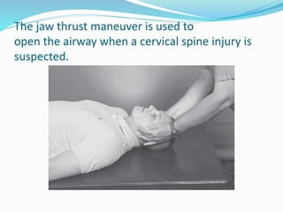 Airway Management Techniques in Emergency Care Lecture 3 | PDF