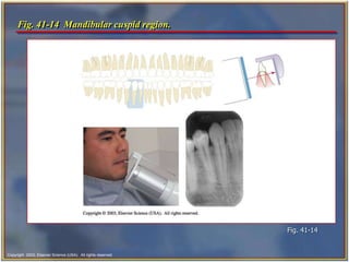 ch41.ppt