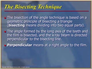Tooth Bisection ch41.ppt