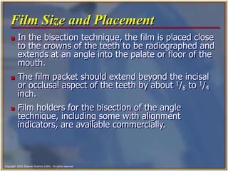 Tooth Bisection ch41.ppt