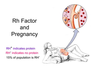 Rh Factor 
and 
Pregnancy 
RH+ indicates protein 
RH- indicates no protein 
15% of population is RH- 
 