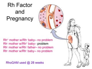 Rh Factor 
and 
Pregnancy 
Rh+ mother w/Rh- baby– no problem 
Rh- mother w/Rh+ baby– problem 
Rh- mother w/Rh- father– no problem 
Rh- mother w/Rh- baby-- no problem 
RhoGAM used @ 28 weeks 
 