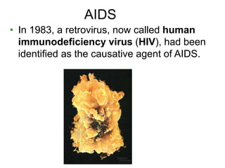 AIDS 
• In 1983, a retrovirus, now called human 
immunodeficiency virus (HIV), had been 
identified as the causative agent of AIDS. 
 