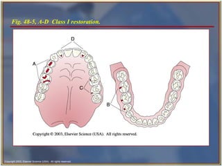 Restorative and Esthetic Dentistry | PPT