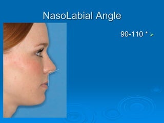 NasoLabial Angle
90-110 *
 