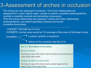 3-Assessment of arches in occlusion
The arches are now assessed in occlusion. The incisor relationships are
assessed first: incisor classifi cation, overjet or anterior crossbites (anteroposterior),
overbite or openbite (vertical) and centrelines (transverse).
Then the buccal relationships are assessed: canine and molar relationships
(anteroposterior), any lateral openbites (vertical) and buccal
crossbites (transverse).
OVERJET :Normally be 2–4 mm
OVERBITE: normal value would be 1/3 coverage of the crown of the lower incisor.
Crossbites • Location (anterior or posterior)
• Nature of the crossbite (see Box 5.5)
 