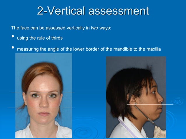 Ch5 orthodontic assessment Dentistry | PDF | Dental Health | Diseases ...