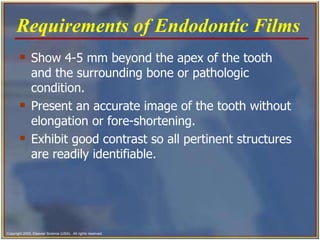 Show 4-5 mm beyond the apex of the tooth and the surrounding bone or pathologic condition.   Present an accurate image of the tooth without elongation or fore-shortening.   Exhibit good contrast so all pertinent structures are readily identifiable.   Requirements of Endodontic Films   