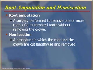 Root amputation A surgery performed to remove one or more roots of a multirooted tooth without removing the crown.   Hemisection A procedure in which the root and the crown are cut lengthwise and removed.   Root Amputation and Hemisection   