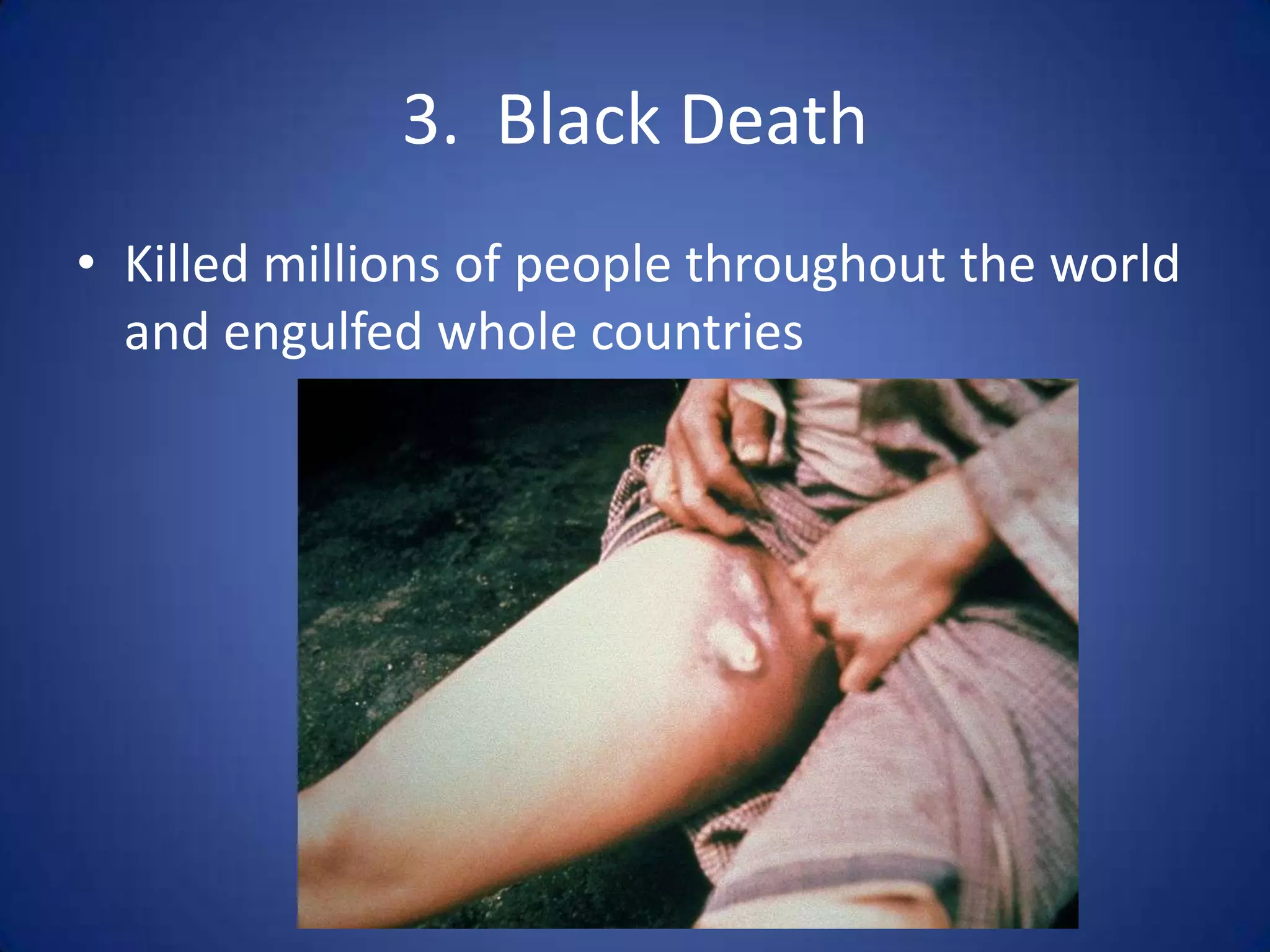 3. Black Death
• Killed millions of people throughout the world
  and engulfed whole countries
 