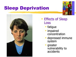 Sleep Deprivation Effects of Sleep Loss fatigue impaired concentration depressed immune system greater vulnerability to accidents 