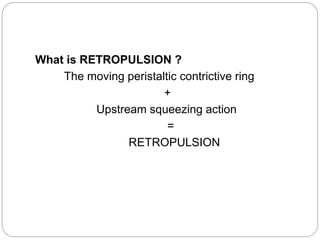 What is RETROPULSION ?
The moving peristaltic contrictive ring
+
Upstream squeezing action
=
RETROPULSION
 