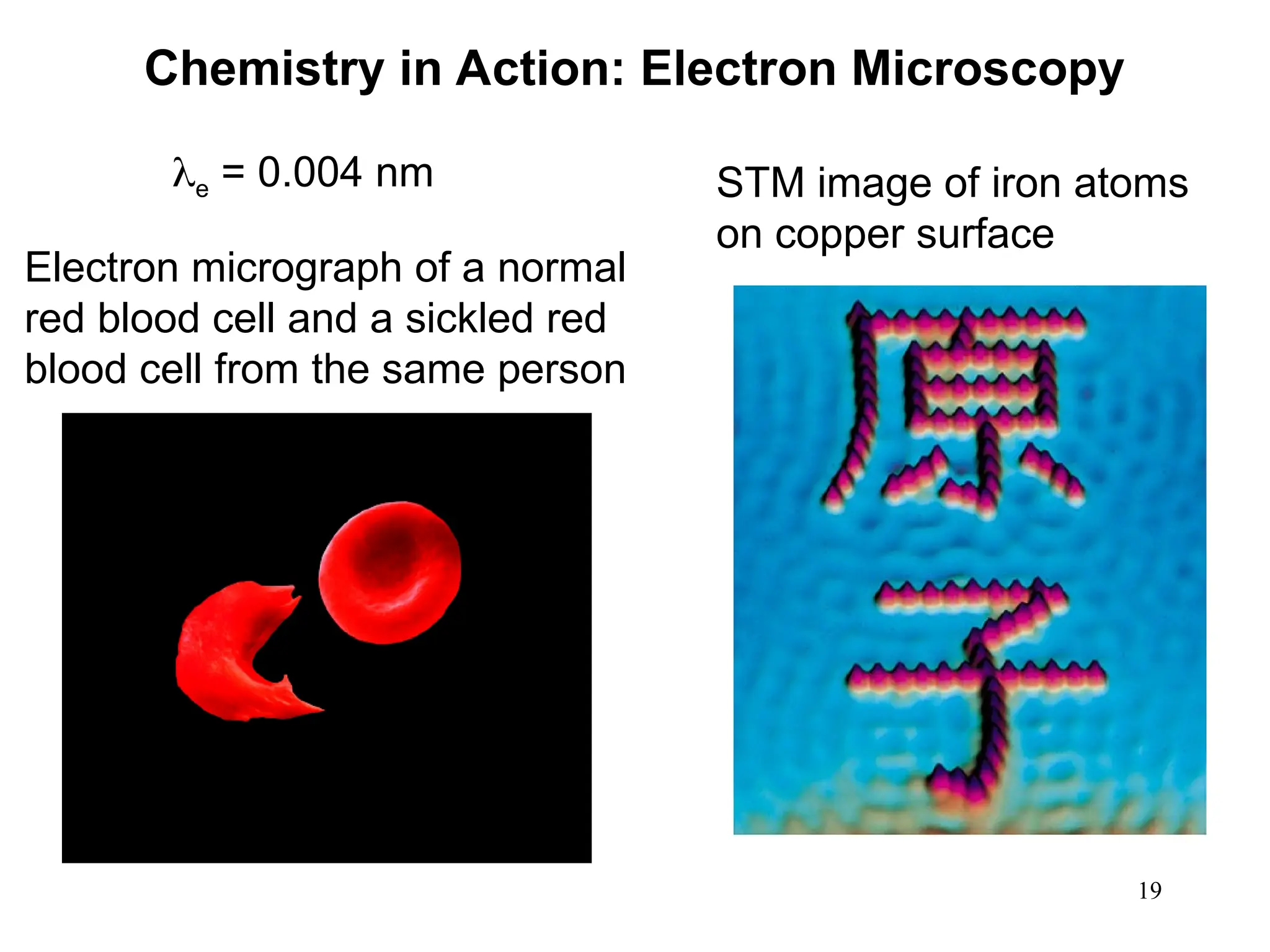19
Chemistry in Action: Electron Microscopy
STM image of iron atoms
on copper surface
e = 0.004 nm
Electron micrograph of a normal
red blood cell and a sickled red
blood cell from the same person
 