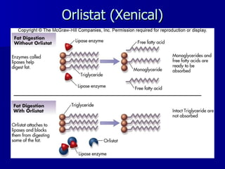 Orlistat (Xenical) 