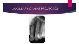 Oral Radiology White and Pharoah Ch 7 Intraoral.pptx