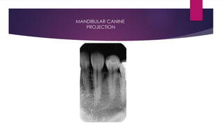 Oral Radiology White and Pharoah Ch 7 Intraoral.pptx