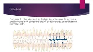 Oral Radiology White and Pharoah Ch 7 Intraoral.pptx