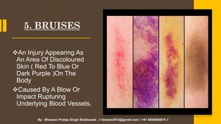 class 12th Ch 7 physiology and injuries in sports by bhawani pratap ...