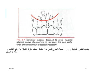 ‫و‬ ‫و‬ ‫و‬ ‫للبابيال‬ ‫الضرر‬ ‫بتجب‬...‫الفالب‬ ‫رفع‬ ‫من‬ ‫ألتمكن‬ ‫دائرة‬ ‫صف‬ ‫عشكل‬ ‫فوق‬ ‫تبعي‬ ‫الجرح‬ ‫فبعمل‬‫و‬
‫العمل‬ ‫مزاولة‬
10/22/2016 14
 