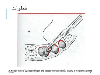 ‫خطوات‬
10/22/2016 38
 