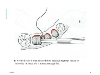 B, Needle holder is then released from needle; it regrasps needle on
underside of tissue and is turned through flap.
10/22/2016 39
 
