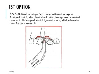 1ST OPTION
FIG. 8-32 Small envelope flap can be reflected to expose
fractured root. Under direct visualization, forceps can be seated
more apically into periodontal ligament space, which eliminates
need for bone removal.
10/22/2016 48
 