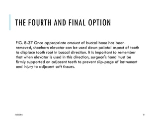 THE FOURTH AND FINAL OPTION
FIG. 8-37 Once appropriate amount of buccal bone has been
removed, shoehorn elevator can be used down palatal aspect of tooth
to displace tooth root in buccal direction. It is important to remember
that when elevator is used in this direction, surgeon's hand must be
firmly supported on adjacent teeth to prevent slip-page of instrument
and injury to adjacent soft tissues.
10/22/2016 51
 