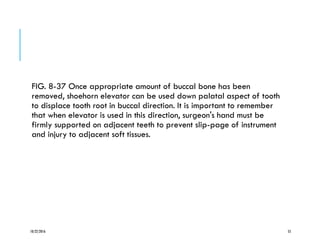 FIG. 8-37 Once appropriate amount of buccal bone has been
removed, shoehorn elevator can be used down palatal aspect of tooth
to displace tooth root in buccal direction. It is important to remember
that when elevator is used in this direction, surgeon's hand must be
firmly supported on adjacent teeth to prevent slip-page of instrument
and injury to adjacent soft tissues.
10/22/2016 55
 
