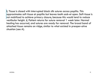 I, Tissue is closed with interrupted black silk sutures across papilla. This
approximates soft tissue at papilla but leaves tooth sock-et open. Soft tissue is
not mobilized to achieve primary closure, because this would tend to reduce
vestibular height. J, Patient returns for suture removal 1 week later. Normal
healing has occurred, and sutures are ready for removal. The broad band of
attached tissue remains on ridge, similar to what existed in preoper-ative
situation (see A).
10/22/2016 97
 