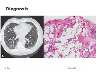 Diagnosis
2014-07-1120
 