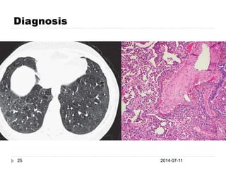 Diagnosis
2014-07-1125
 