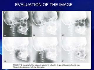 EVALUATION OF THE IMAGE
 