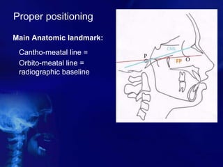 Proper positioning
Main Anatomic landmark:
Cantho-meatal line =
Orbito-meatal line =
radiographic baseline
 