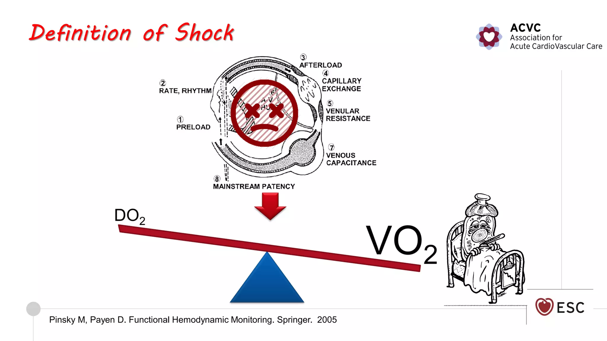 2020 Cardiogenic shock definition and epidemiology | PDF