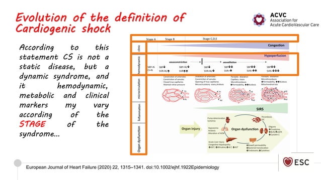 2020 Cardiogenic shock definition and epidemiology | PDF