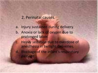 2. Perinatal causes.

a. Injury sustained during delivery.
b. Anoxia or lack of oxygen due to
   prolonged labor.
c. Heavy sedation due to overdose of
   anesthesia in twilight deliveries.
d. Blockage of the infant’s respiratory
   passage.
 