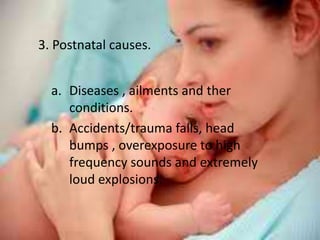 3. Postnatal causes.


  a. Diseases , ailments and ther
     conditions.
  b. Accidents/trauma falls, head
     bumps , overexposure to high
     frequency sounds and extremely
     loud explosions.
 