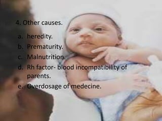4. Other causes.
a. heredity.
b. Prematurity.
c. Malnutrition.
d. Rh factor- blood incompatibility of
   parents.
e. Overdosage of medecine.
 