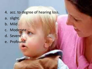 4.   acc. to degree of hearing loss.
a.   slight.
b.   Mild .
c.   Moderate .
d.   Severe .
e.   Profound.
 