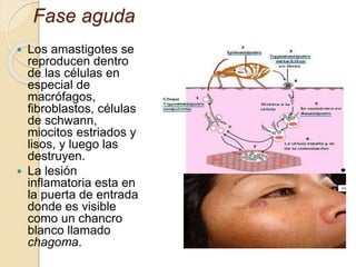 Fase aguda
 Los amastigotes se
reproducen dentro
de las células en
especial de
macrófagos,
fibroblastos, células
de schwann,
miocitos estriados y
lisos, y luego las
destruyen.
 La lesión
inflamatoria esta en
la puerta de entrada
donde es visible
como un chancro
blanco llamado
chagoma.
 