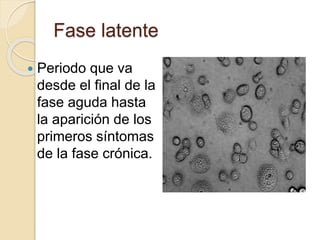 Fase latente
 Periodo que va
desde el final de la
fase aguda hasta
la aparición de los
primeros síntomas
de la fase crónica.
 