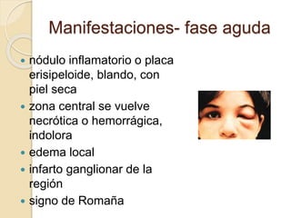 Manifestaciones- fase aguda
 nódulo inflamatorio o placa
erisipeloide, blando, con
piel seca
 zona central se vuelve
necrótica o hemorrágica,
indolora
 edema local
 infarto ganglionar de la
región
 signo de Romaña
 